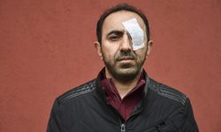 İSTANBUL - Kameramanın kornea nakli yapılan gözüne yumruk atıldığı kavgaya ilişkin 6 kişiye dava