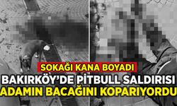 Bakırköy'de pitbull saldırısı: Bacağını parçaladı