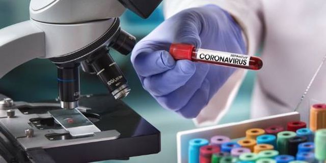 29 Nisan günlük Koronavirüs vaka tablosu