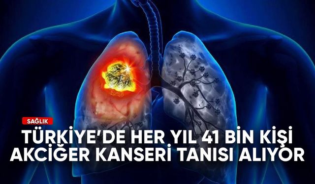 Türkiye'de her yıl 41 bin kişi akciğer kanseri tanısı alıyor
