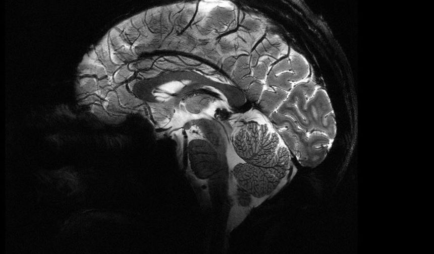 MRI cihazıyla çekilen insan beyninin en net görüntüsü yayınlandı